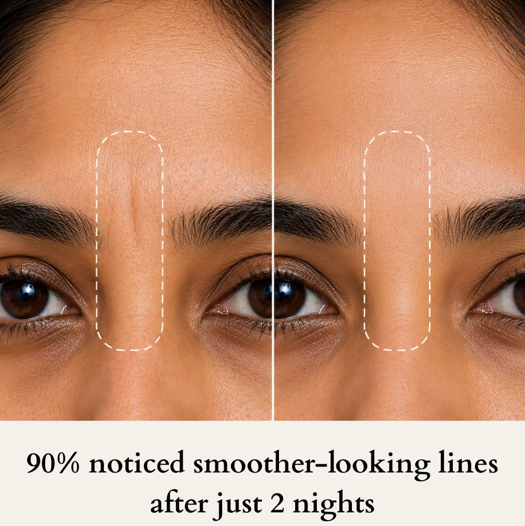 Before and after comparison of a woman's eye area with text indicating smoother-looking lines after 2 nights.